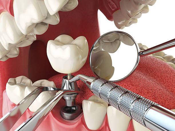 Best Emergency Denture Repair in Petersburg, AK